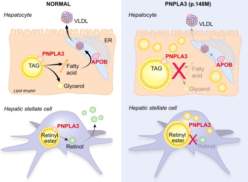 Figure 1. PNPLA3 gene in liver diseases. (Trépo E, et al., 2016)