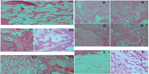 Fig2. The newly formed bone was surrounded with fibro-vascular tissues and this defect might be fully repaired withtime