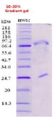 Protein L Agarose High Flow Resin,Protein L Agarose High Flow Resin