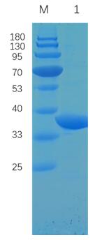 Reducing 12% SDS-PAGE analysis profile of purified PL pro (CBB stained).