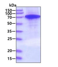 SDS-PAGE and coomassie blue stain.