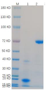1. NFATC3-01H <br />2. BSA