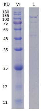 12% SDS-PAGE analysis profiles of purified PA4282-209-1114 (CBB stained)