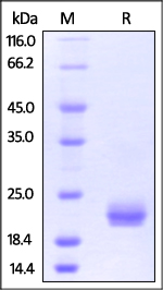 Human ROR1 (165-305, Frizzled domain), His Tag on SDS-PAGE under reducing (R) condition. The gel was stained overnight with Coomassie Blue. The purity of the protein is greater than 95%.