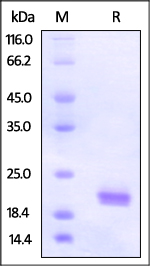 The purity of Human ROR1 (308-395, Kringle domain), His Tag was determined by SDS-PAGE under reducing (R) condition and staining overnight with Coomassie Blue.