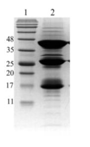 SDS-PAGE<br />Lane 1. Size marker. Lane 2. Human cardiac troponin complex