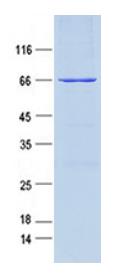 SDS-PAGE gel and Coomossie Blue Staining