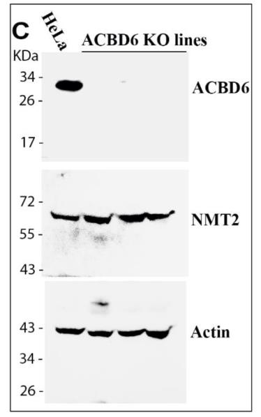 ACBD6-2178H-3.jpg