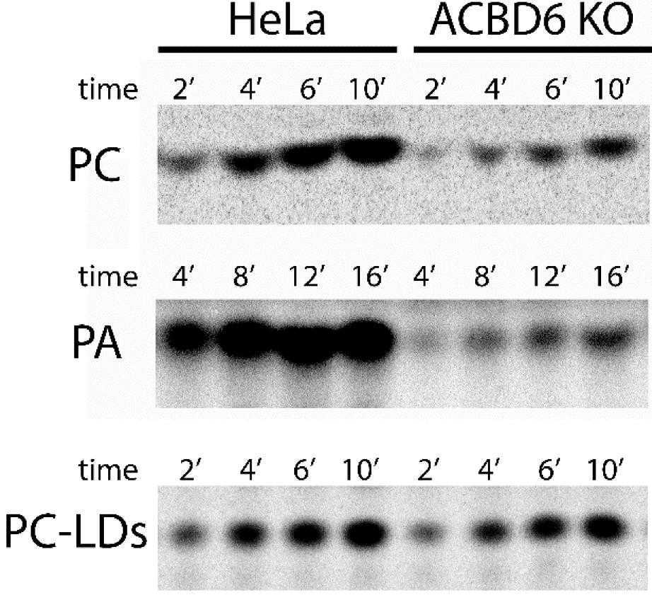 ACBD6-2178H-4.jpg