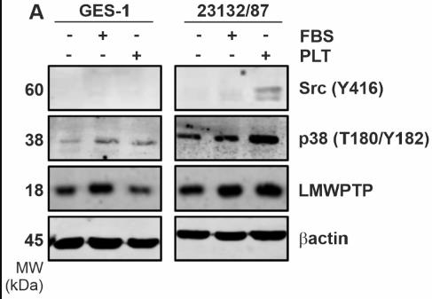ACP1-1146H-3.jpg