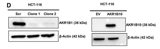 AKR1B1-2496H-1.jpg