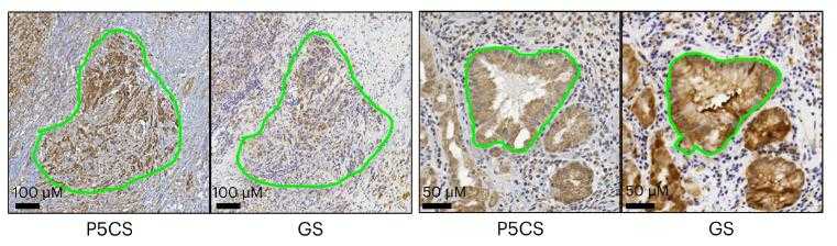 ALDH18A1-2882H-2.jpg