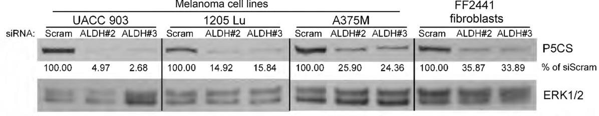 ALDH18A1-2882H-3.jpg