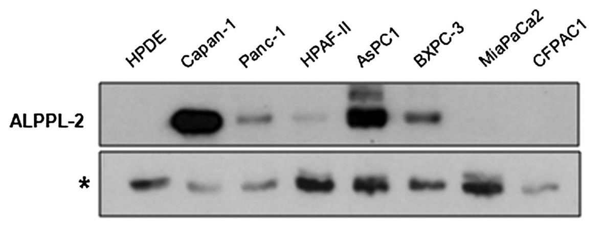ALPG-3335H-4.jpg
