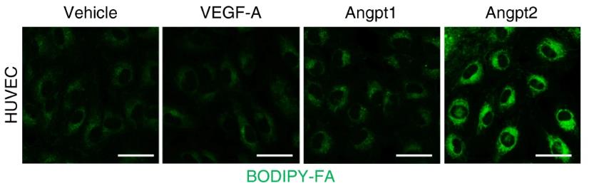 ANGPT2-3182H-1.jpg