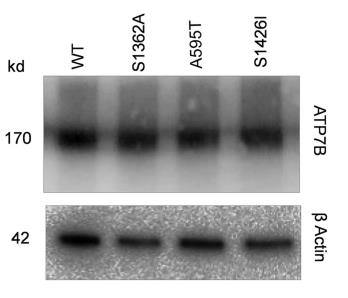 ATP7B-1.jpg