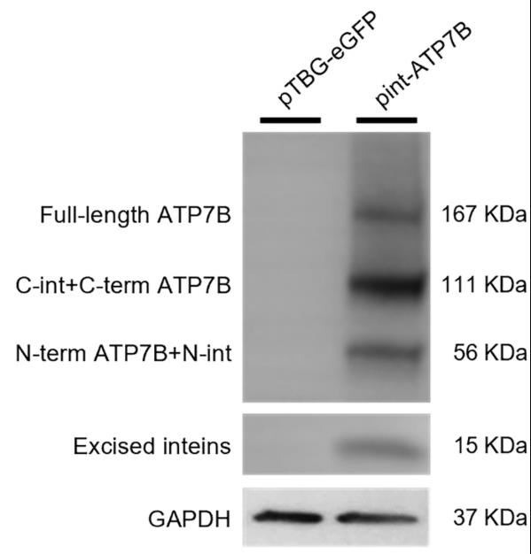 ATP7B-3.jpg