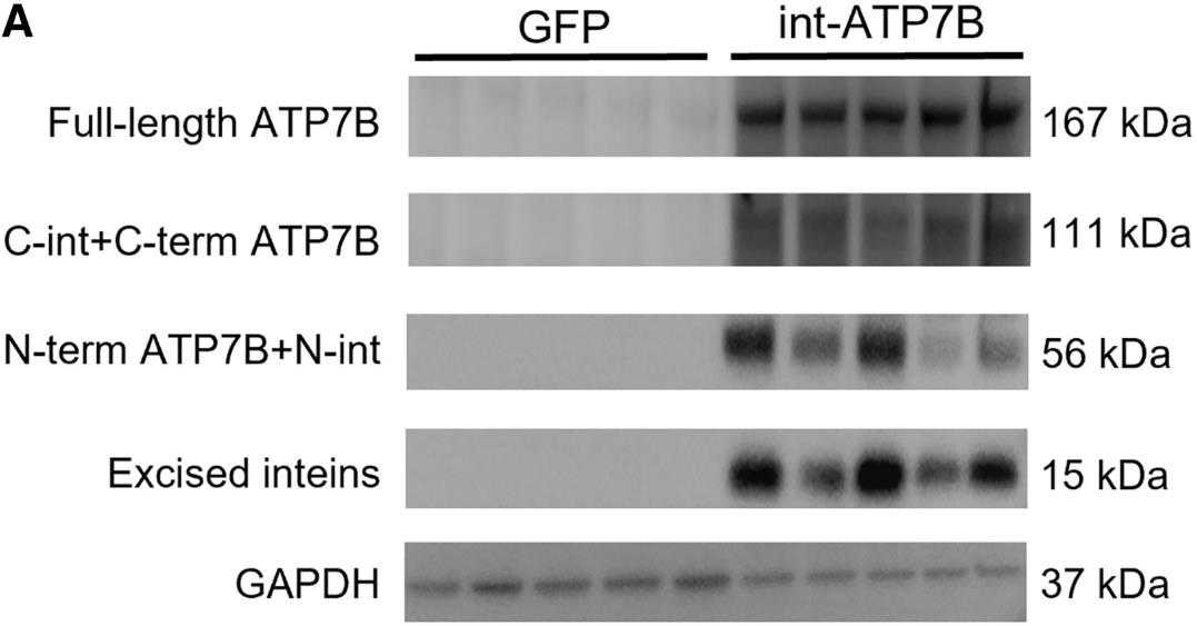 ATP7B-4.jpg