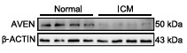 AVEN-1.jpg
