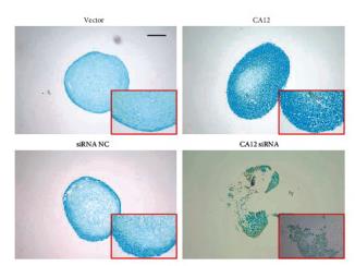CA12-261H-4.jpg