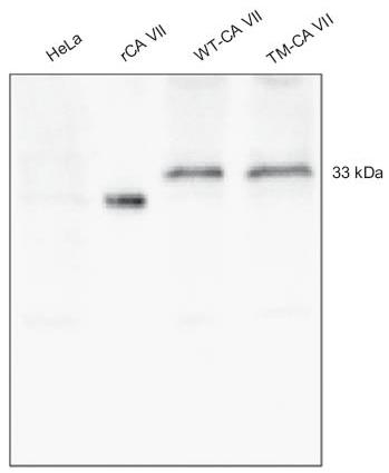 CA7-2499H-1.jpg