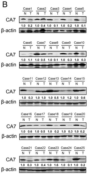 CA7-2499H-3.jpg
