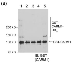CARM1-1.jpg
