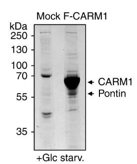 CARM1-3.jpg
