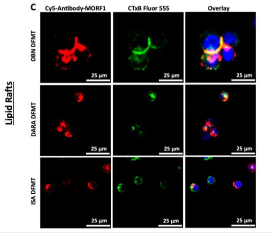 CD38-3.jpg