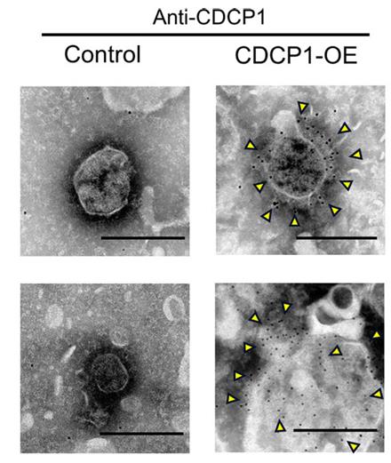 CDCP1-2.jpg