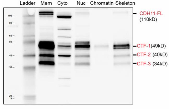 CDH11-4.jpg