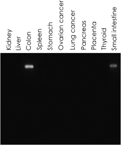CDH17-2043H-3.jpg