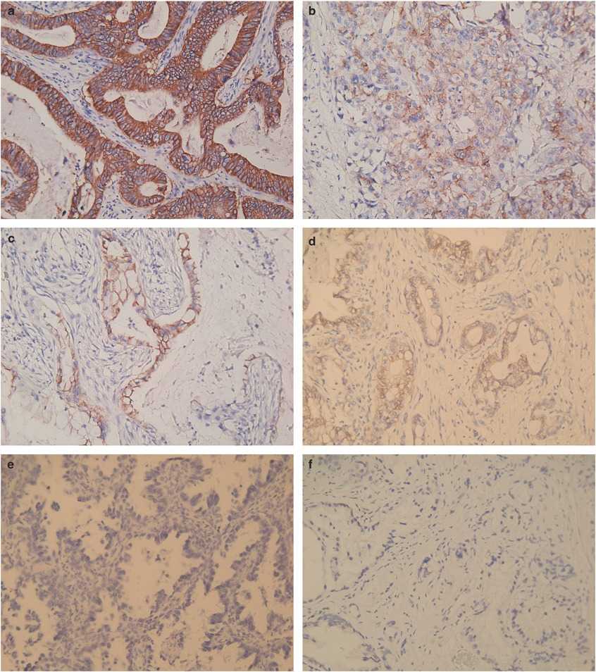 CDH17-2043H-4.jpg