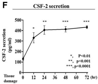 CSF2-1.jpg