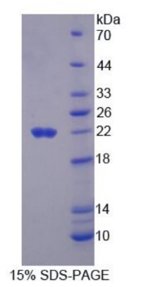 CTAG1B-1.jpg