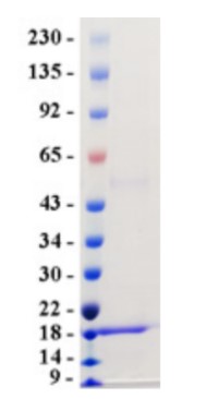 CTAG1B-2.jpg