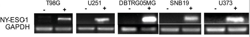 CTAG1B-3.jpg