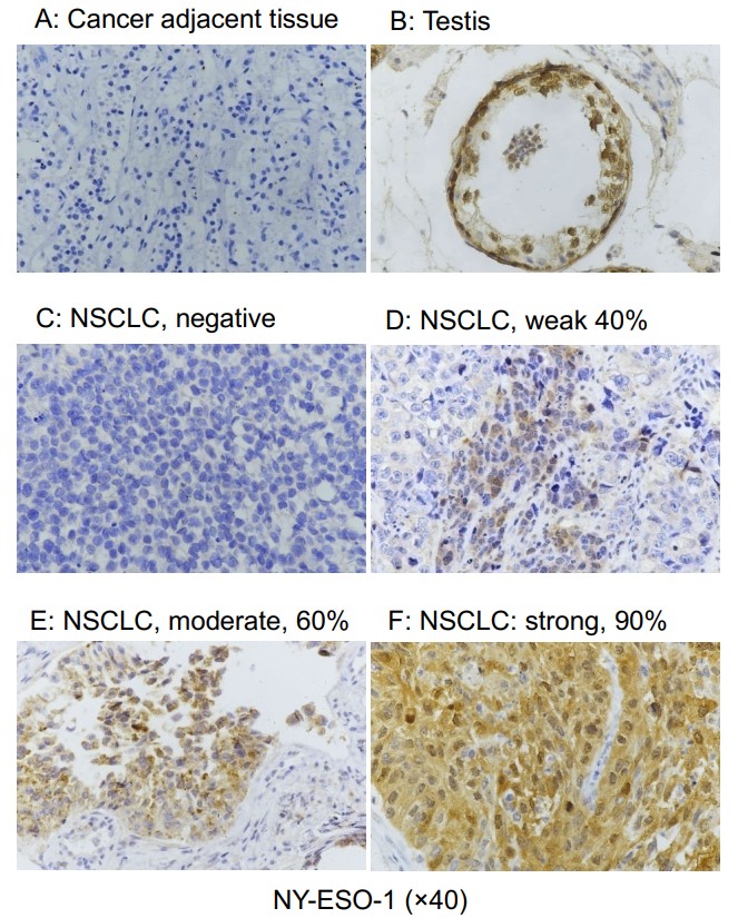 CTAG1B-5.jpg