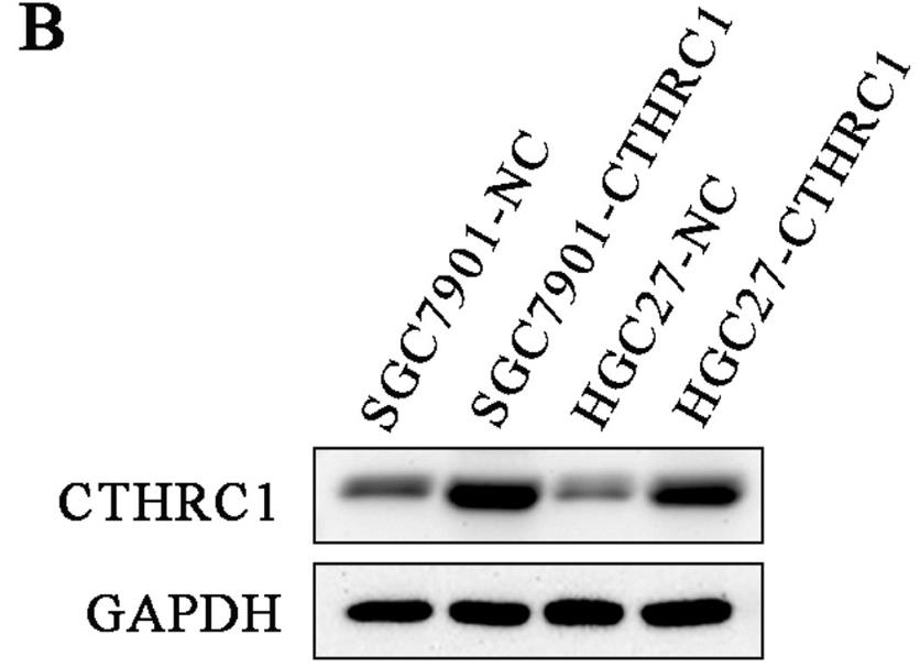 CTHRC1-5254H-1.jpg