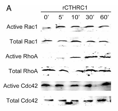 CTHRC1-5254H-3.jpg