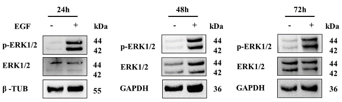 CTSD-4.jpg