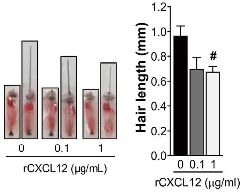 CXCL12-3.jpg