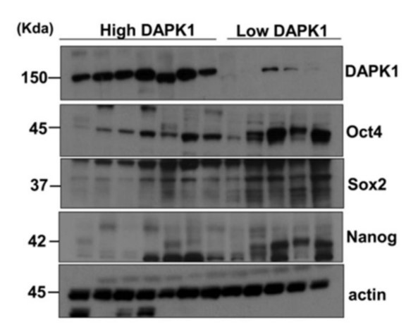 DAPK1-4.jpg