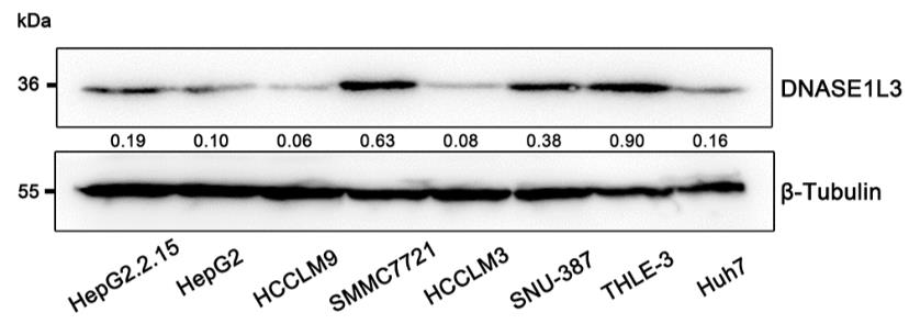 DNASE1L3-1.jpg