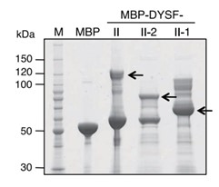DYSF-3.jpg