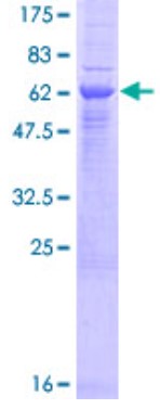 ERAP2_SDS-PAGE.jpg