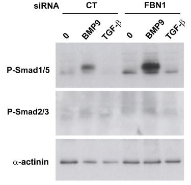 FBN1-4.jpg
