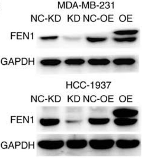 FEN1-3.jpg