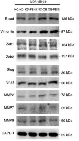 FEN1-4.jpg