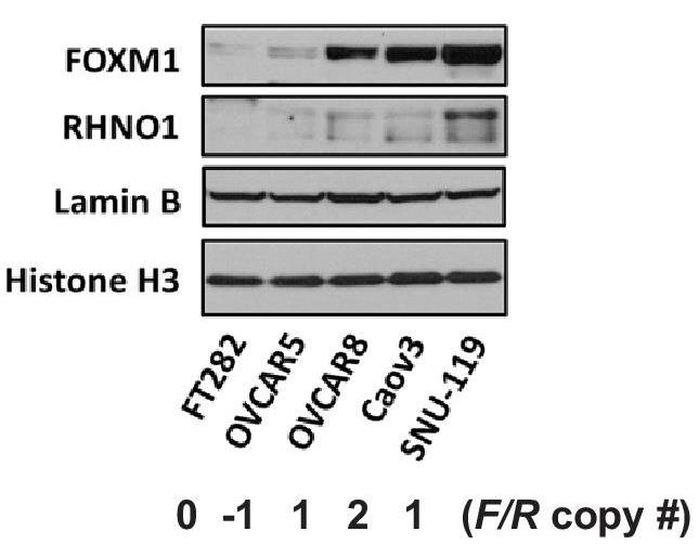 FOXM1-3.jpg